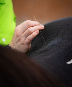 Dry Needling